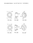 SHAPE ADAPTABLE INTRAMEDULLARY FIXATION DEVICE diagram and image