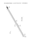 SHAPE ADAPTABLE INTRAMEDULLARY FIXATION DEVICE diagram and image