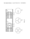 SHAPE ADAPTABLE INTRAMEDULLARY FIXATION DEVICE diagram and image