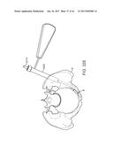 SHAPE ADAPTABLE INTRAMEDULLARY FIXATION DEVICE diagram and image