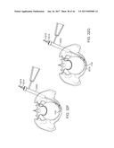 SHAPE ADAPTABLE INTRAMEDULLARY FIXATION DEVICE diagram and image