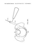 SHAPE ADAPTABLE INTRAMEDULLARY FIXATION DEVICE diagram and image