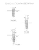 ANCHOR HAVING A CONTROLLED DRIVER ORIENTATION diagram and image