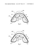 NON-CUSTOM DENTAL TRAY HAVING ANATOMICAL CUSPID-BICUSPID CUTS AND/OR V OR     U-SHAPED INDENTATION IN BOTTOM WALL diagram and image