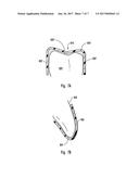 NON-CUSTOM DENTAL TRAY HAVING ANATOMICAL CUSPID-BICUSPID CUTS AND/OR V OR     U-SHAPED INDENTATION IN BOTTOM WALL diagram and image