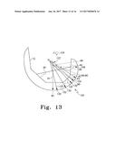 ORTHOPAEDIC KNEE PROSTHESIS HAVING CONTROLLED CONDYLAR CURVATURE diagram and image