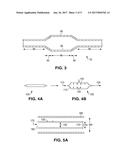 DEFORMATION OF A POLYMER TUBE IN THE FABRICATION OF A MEDICAL ARTICLE diagram and image