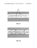 DEFORMATION OF A POLYMER TUBE IN THE FABRICATION OF A MEDICAL ARTICLE diagram and image