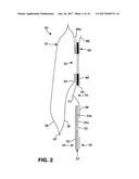 OSTOMY POUCH APPLIANCE diagram and image