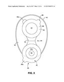 OSTOMY POUCH APPLIANCE diagram and image