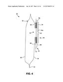 OSTOMY POUCH APPLIANCE diagram and image