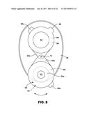 OSTOMY POUCH APPLIANCE diagram and image