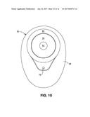 OSTOMY POUCH APPLIANCE diagram and image