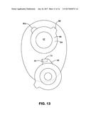 OSTOMY POUCH APPLIANCE diagram and image