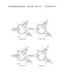 HIGH FLOW NASAL THERAPY SYSTEM diagram and image