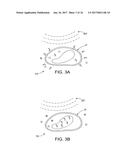 METHODS AND SYSTEMS FOR TOXIN DELIVERY TO THE NASAL CAVITY diagram and image