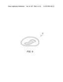 METHODS AND SYSTEMS FOR TOXIN DELIVERY TO THE NASAL CAVITY diagram and image