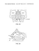 METHODS AND SYSTEMS FOR TOXIN DELIVERY TO THE NASAL CAVITY diagram and image