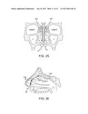 METHODS AND SYSTEMS FOR TOXIN DELIVERY TO THE NASAL CAVITY diagram and image