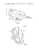 Systems and Methods for Enabling Appetite Modulation and/or Improving     Dietary Compliance Using an Electro-Dermal Patch diagram and image