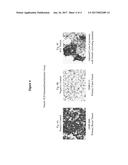 METHODS FOR TREATING CANCER WITH NOTCH1 ANTIBOIDES diagram and image