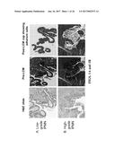 MICRORNA ASSAY FOR DETECTION AND MANAGEMENT OF PANCREATIC CANCER     PRECURSORS diagram and image