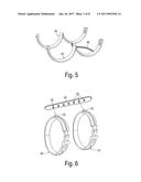 FLEXIBLE TURBOCHARGER AIR DUCT WITH CONSTRICTING RINGS diagram and image