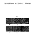 ENGINEERED THREE-DIMENSIONAL BREAST TISSUE, ADIPOSE TISSUE, AND TUMOR     DISEASE MODEL diagram and image