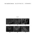 ENGINEERED THREE-DIMENSIONAL BREAST TISSUE, ADIPOSE TISSUE, AND TUMOR     DISEASE MODEL diagram and image