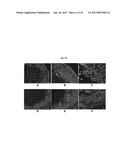 ENGINEERED THREE-DIMENSIONAL BREAST TISSUE, ADIPOSE TISSUE, AND TUMOR     DISEASE MODEL diagram and image