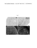 ENGINEERED THREE-DIMENSIONAL BREAST TISSUE, ADIPOSE TISSUE, AND TUMOR     DISEASE MODEL diagram and image