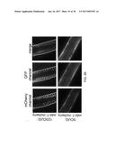 Tools and Methods for Targeting Oligonucleotide Repeat RNA Toxicity diagram and image