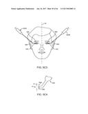 CONFORMABLE THERAPEUTIC SHIELD FOR VISION AND PAIN diagram and image