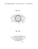 IMAGING APPARATUS AND METHOD OF OPERATING THE SAME diagram and image