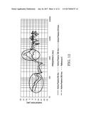 NOISE-CANCELLING HEADPHONE diagram and image