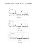 RADIO WITH INTERFERENCE MEASUREMENT DURING A BLANKING INTERVAL diagram and image