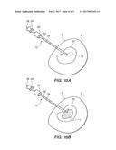 MEDICAL PROBE WITH ECHOGENIC AND INSULATIVE PROPERTIES diagram and image