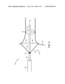 ABLATION CATHETER diagram and image