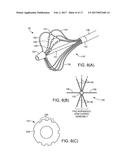 ABLATION CATHETER diagram and image