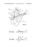 ABLATION CATHETER diagram and image