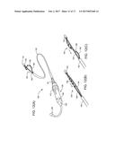 ABLATION CATHETER diagram and image