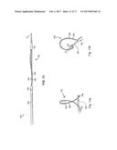 ABLATION CATHETER diagram and image