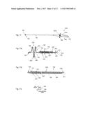 ABLATION CATHETER diagram and image