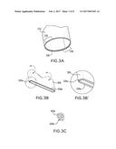 Self-Assembling Modular Percutaneous Valve and Methods of Folding,     Assembly and Delivery diagram and image