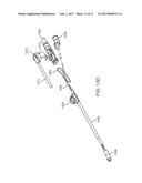 SINUS DILATION CATHETER diagram and image