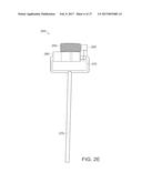 DEVICES AND METHODS FOR VERTEBROSTENTING diagram and image