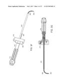 DEVICES AND METHODS FOR VERTEBROSTENTING diagram and image