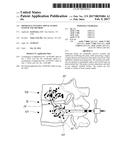 MINIMALLY INVASIVE SPINAL FUSION SYSTEM AND METHOD diagram and image