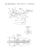 Method for Treating a Tubular Anatomical Structure diagram and image