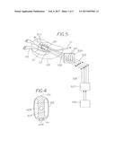 Method for Treating a Tubular Anatomical Structure diagram and image